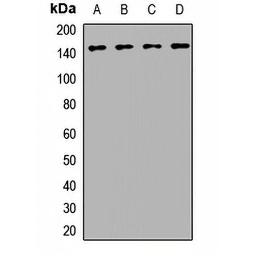 BRIP1 Rabbit Polyclonal Antibody