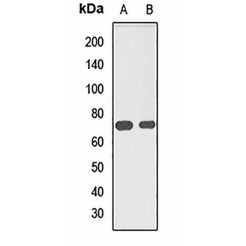 MUS81 Rabbit Polyclonal Antibody