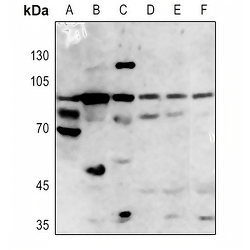 ACSL4 Rabbit Polyclonal Antibody