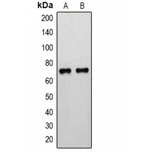 15-LO Rabbit Polyclonal Antibody