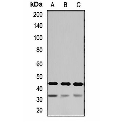 ASGR1 Rabbit Polyclonal Antibody