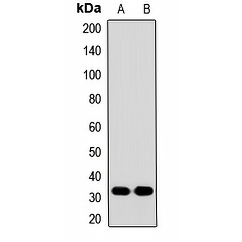 CAC Rabbit Polyclonal Antibody