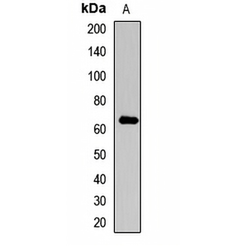 Collagen 10 alpha 1 Rabbit Polyclonal Antibody