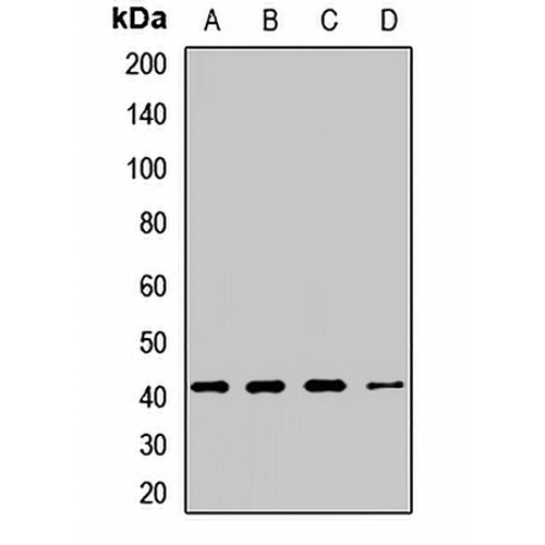 Cystinosin Rabbit Polyclonal Antibody