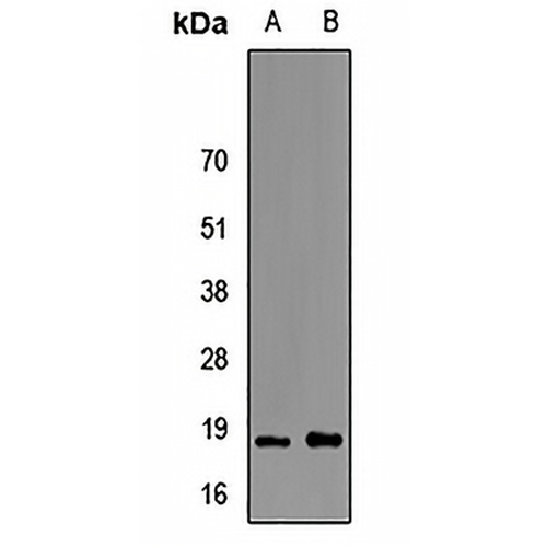 FABP6 Rabbit Polyclonal Antibody