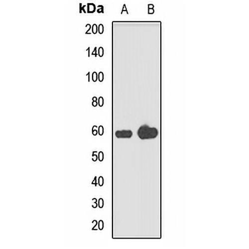 PFKFB3 Rabbit Polyclonal Antibody