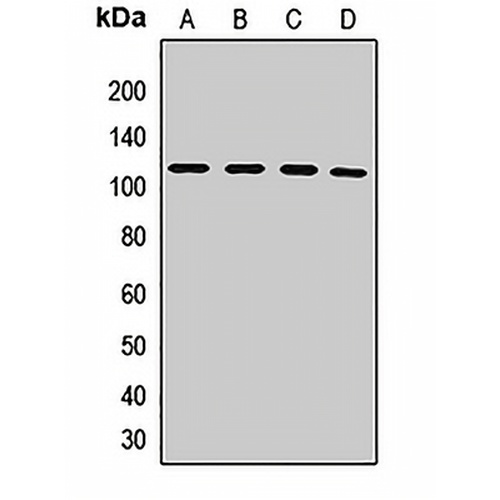 PMS2 Rabbit Polyclonal Antibody