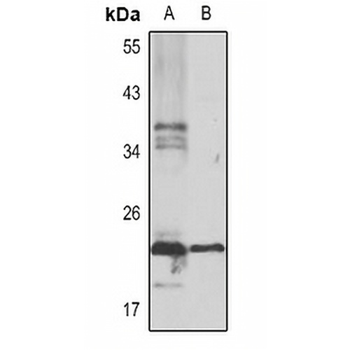 Serglycin Rabbit Polyclonal Antibody