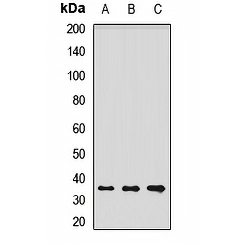 Laforin Rabbit Polyclonal Antibody