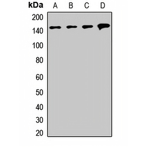 SMC1A Rabbit Polyclonal Antibody