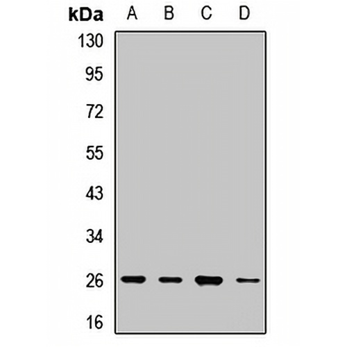 ARD1 Rabbit Polyclonal Antibody