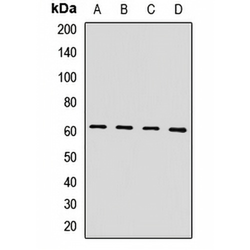 HIRIP3 Rabbit Polyclonal Antibody