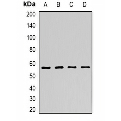 NMT2 Rabbit Polyclonal Antibody