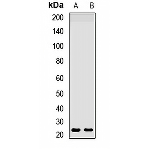 HAND2 Rabbit Polyclonal Antibody
