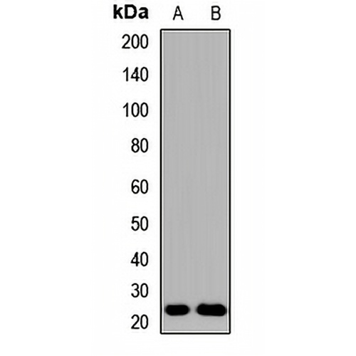 Grancalcin Rabbit Polyclonal Antibody