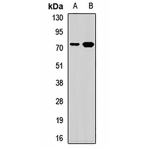 TRMT2A Rabbit Polyclonal Antibody