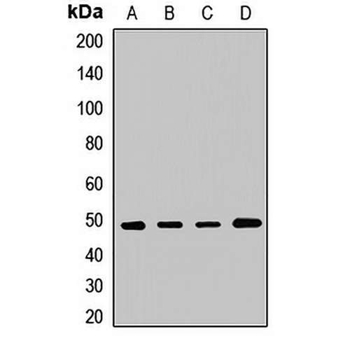 VPS4A Rabbit Polyclonal Antibody