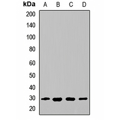 EAF2 Rabbit Polyclonal Antibody