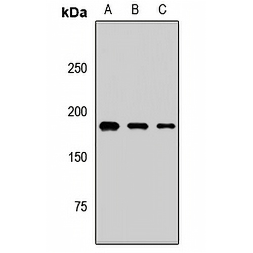 ALS2CR6 Rabbit Polyclonal Antibody