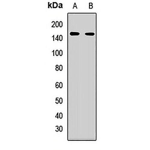 REST Rabbit Polyclonal Antibody