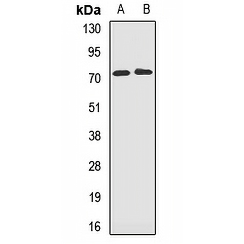 GSTCD Rabbit Polyclonal Antibody