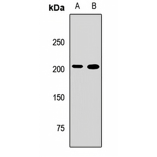 PHIP Rabbit Polyclonal Antibody