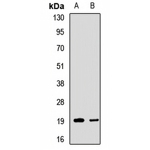 SSAT2 Rabbit Polyclonal Antibody
