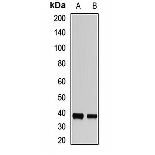 TOB2 Rabbit Polyclonal Antibody