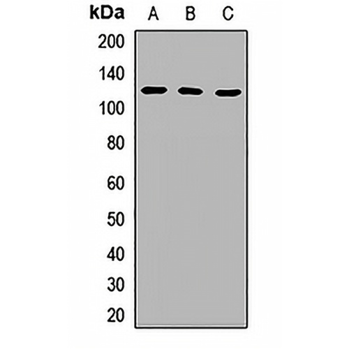 RAP80 Rabbit Polyclonal Antibody