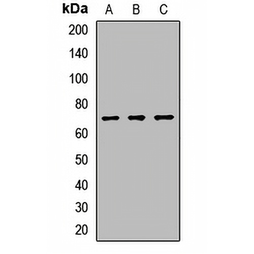 ATMIN Rabbit Polyclonal Antibody