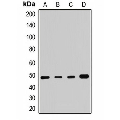 SMYD3 Rabbit Polyclonal Antibody