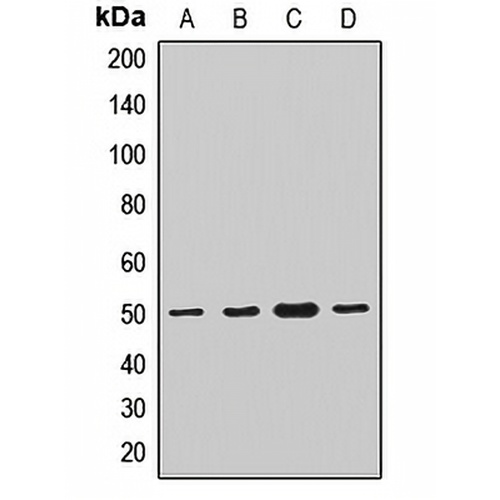 TMLHE Rabbit Polyclonal Antibody