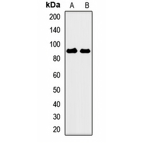 CSRP2BP Rabbit Polyclonal Antibody