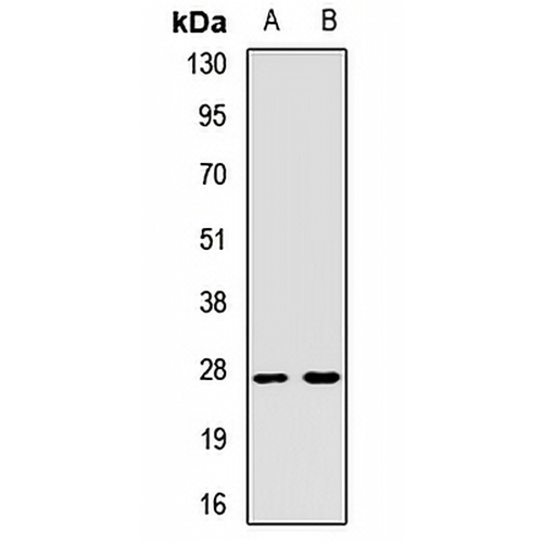 NAT-15 Rabbit Polyclonal Antibody