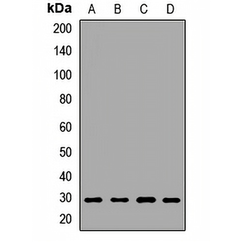 SPIN2B Rabbit Polyclonal Antibody
