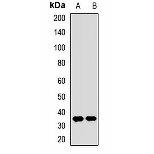 SULT1E1 Rabbit Polyclonal Antibody