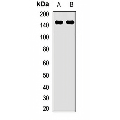 ULK4 Rabbit Polyclonal Antibody