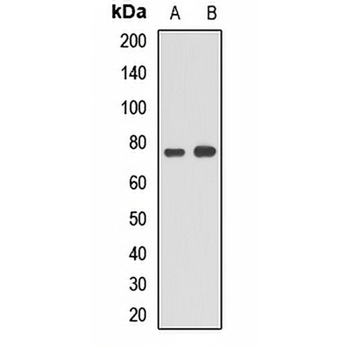 ACSL5 Rabbit Polyclonal Antibody