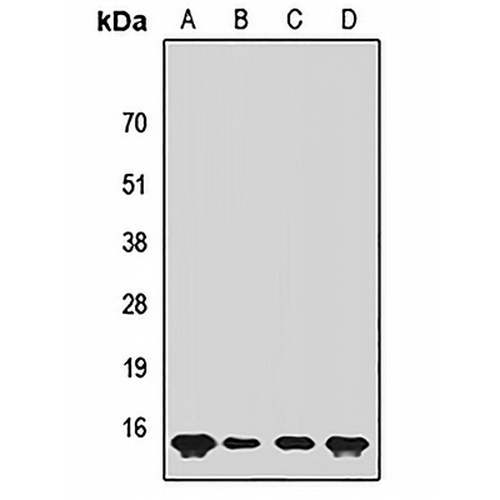 SUMO4 Rabbit Polyclonal Antibody