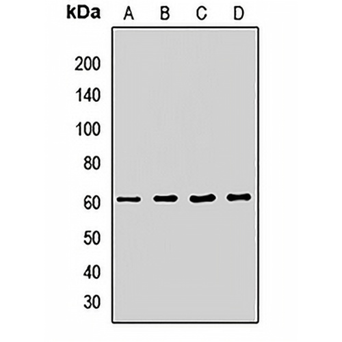 ATG14 Rabbit Polyclonal Antibody