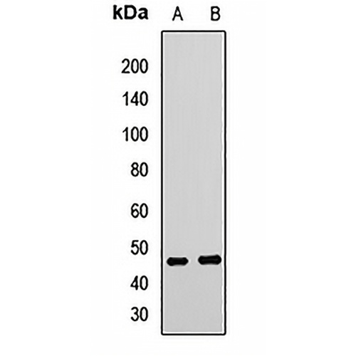 TARBP2 Rabbit Polyclonal Antibody