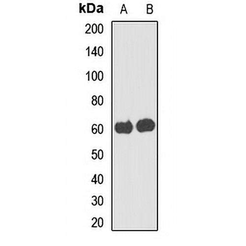 UGT3A2 Rabbit Polyclonal Antibody