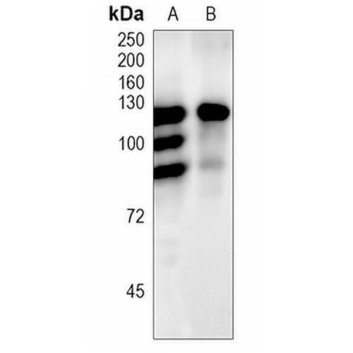 ChREBP Rabbit Polyclonal Antibody