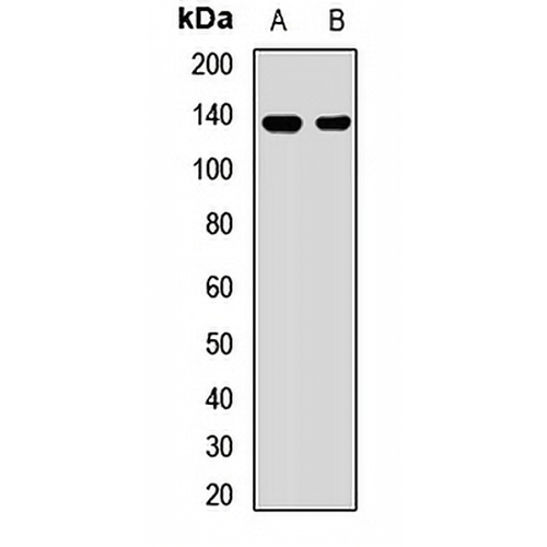 AE2 Rabbit Polyclonal Antibody