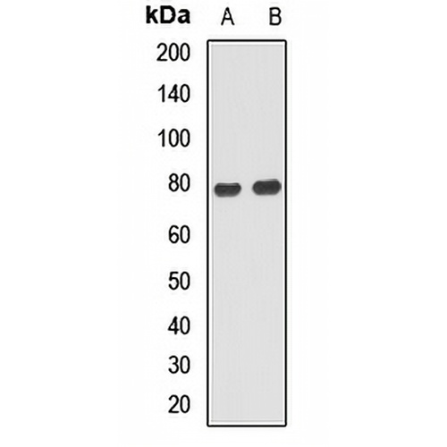 ANKS1B Rabbit Polyclonal Antibody