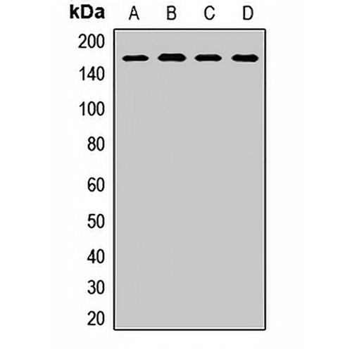 SAF-B1 Rabbit Polyclonal Antibody