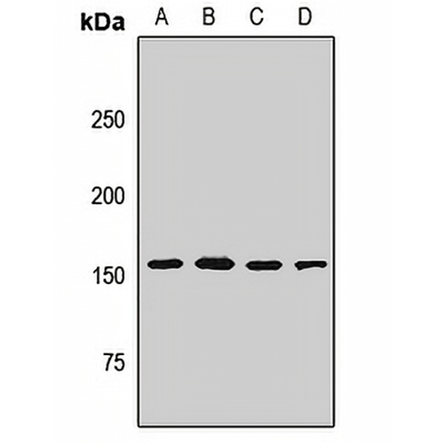 HELIC1 Rabbit Polyclonal Antibody