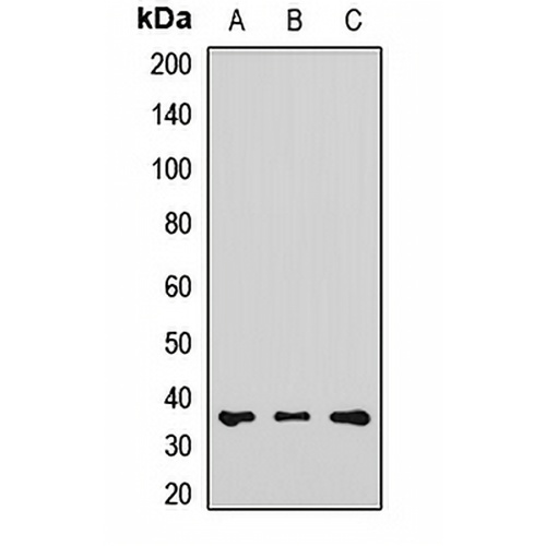 RDH5 Rabbit Polyclonal Antibody