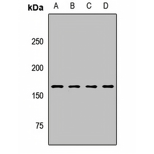 CPS1 Rabbit Polyclonal Antibody