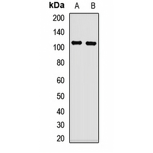 TRPC6 Rabbit Polyclonal Antibody